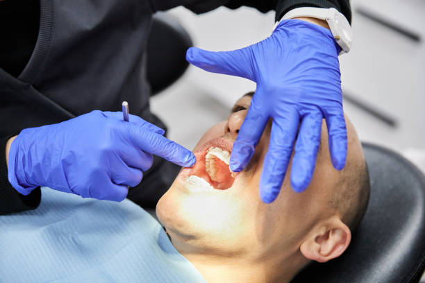 Best Emergency Tooth Extraction in Glide, OR